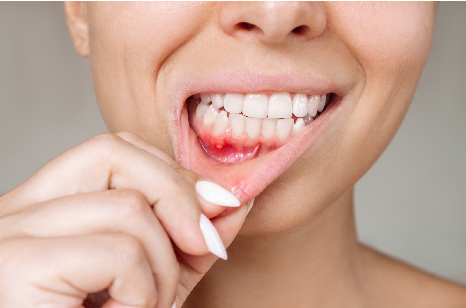 8 Symptoms of Gum Disease You Should Know
