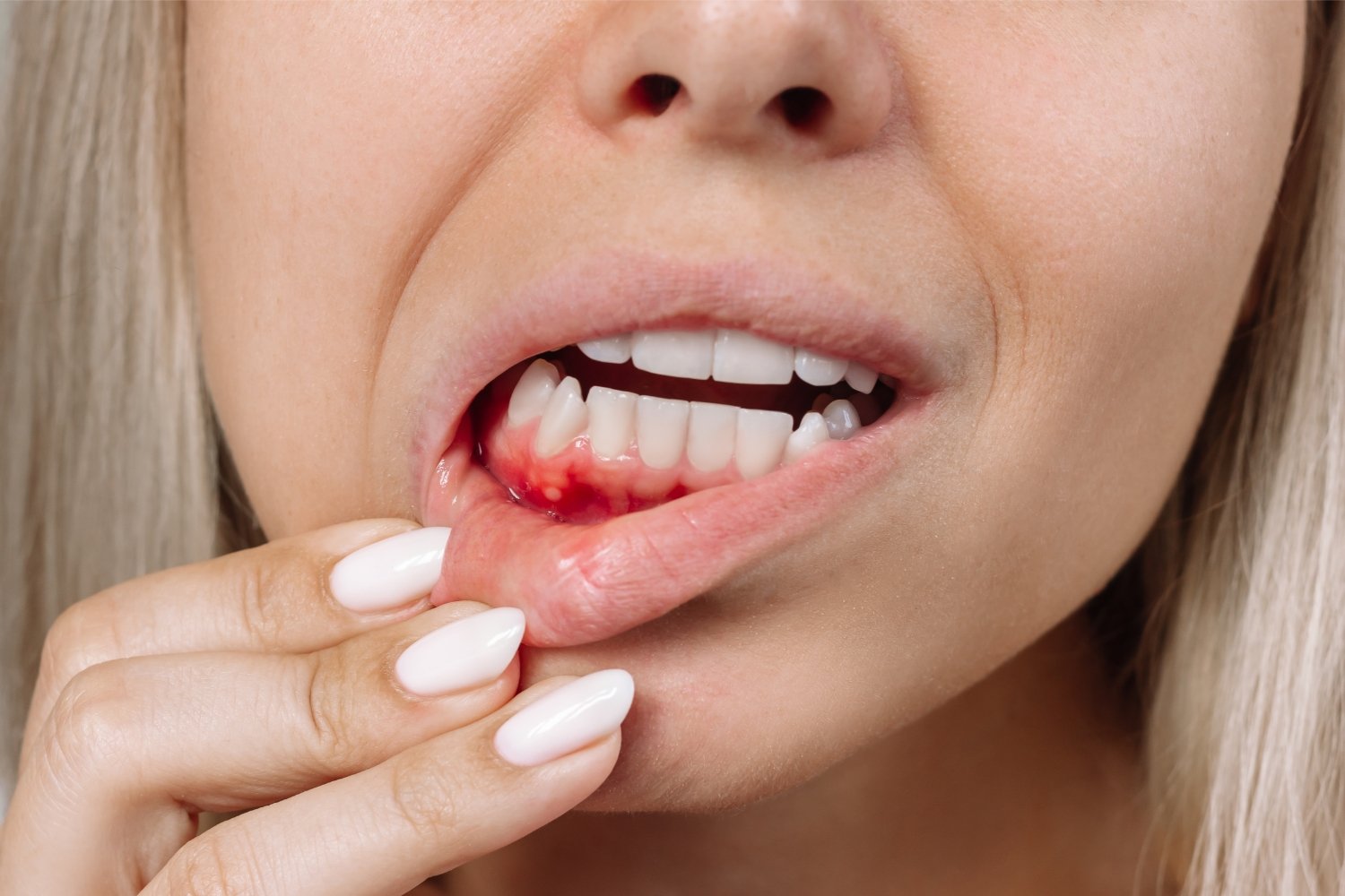 What Are the Early Signs of Gum Disease? 7 Symptoms to Watch For