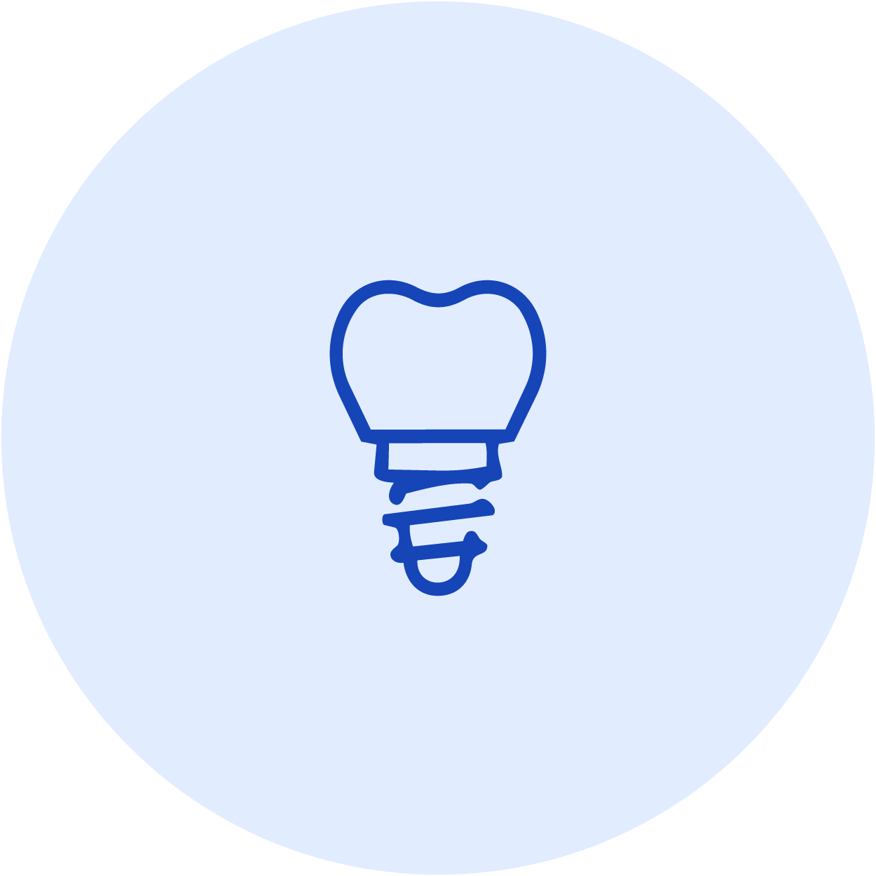 Dental Implants