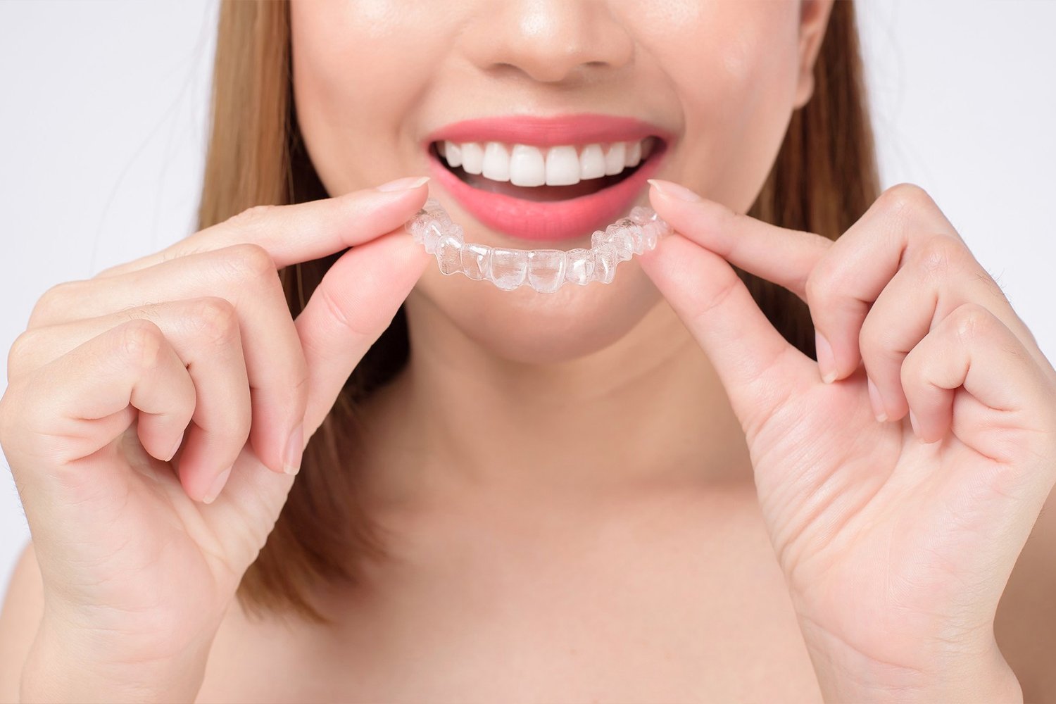 Invisalign or Braces in Bayswater